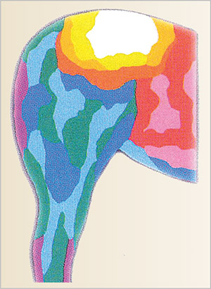 Infrared thermographic imaging showing increased temperature in the region of the upper right sacroiliac joint due to sublaxation.