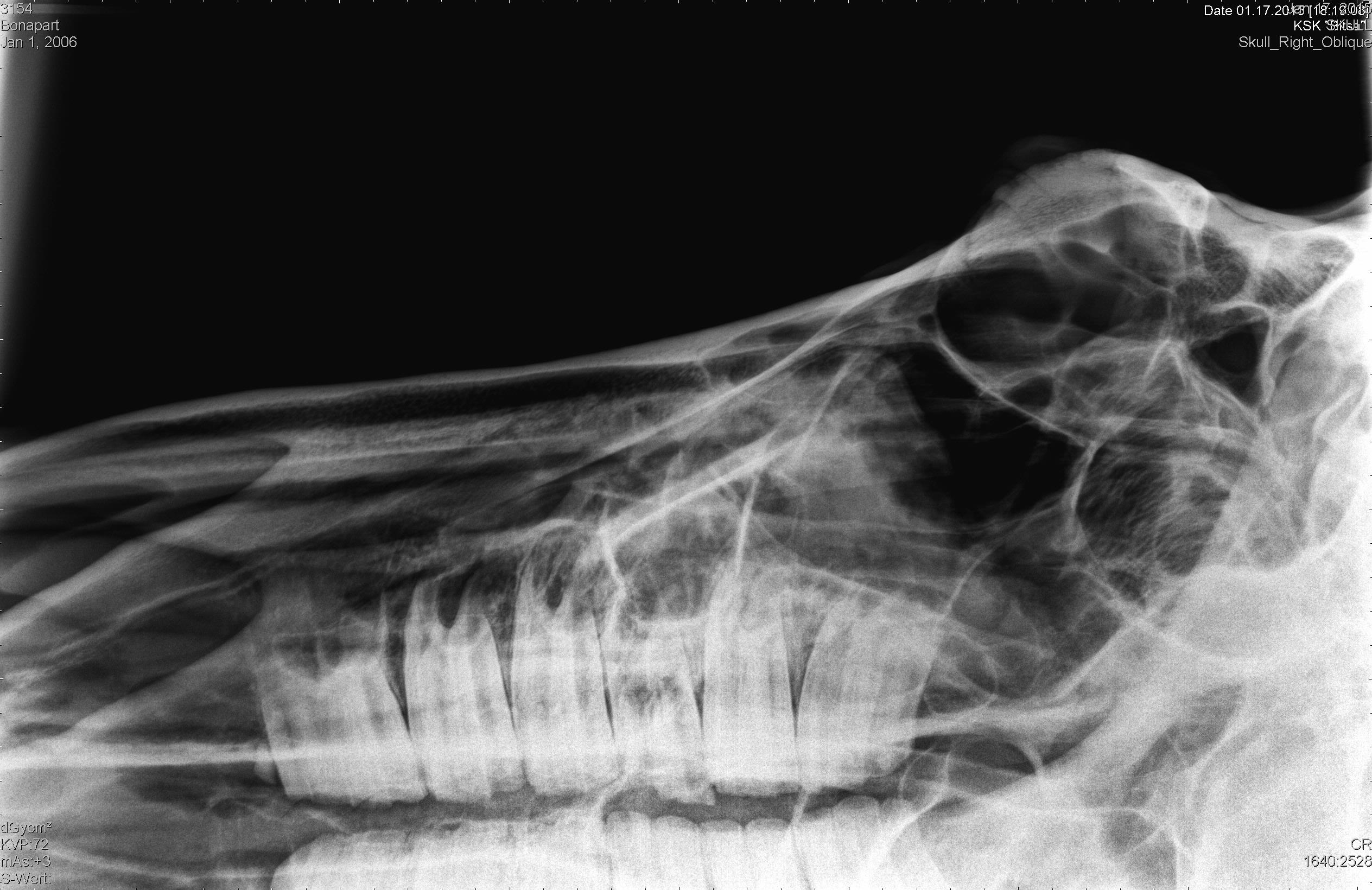 3154_Bonapart_20060101_1.jpg
