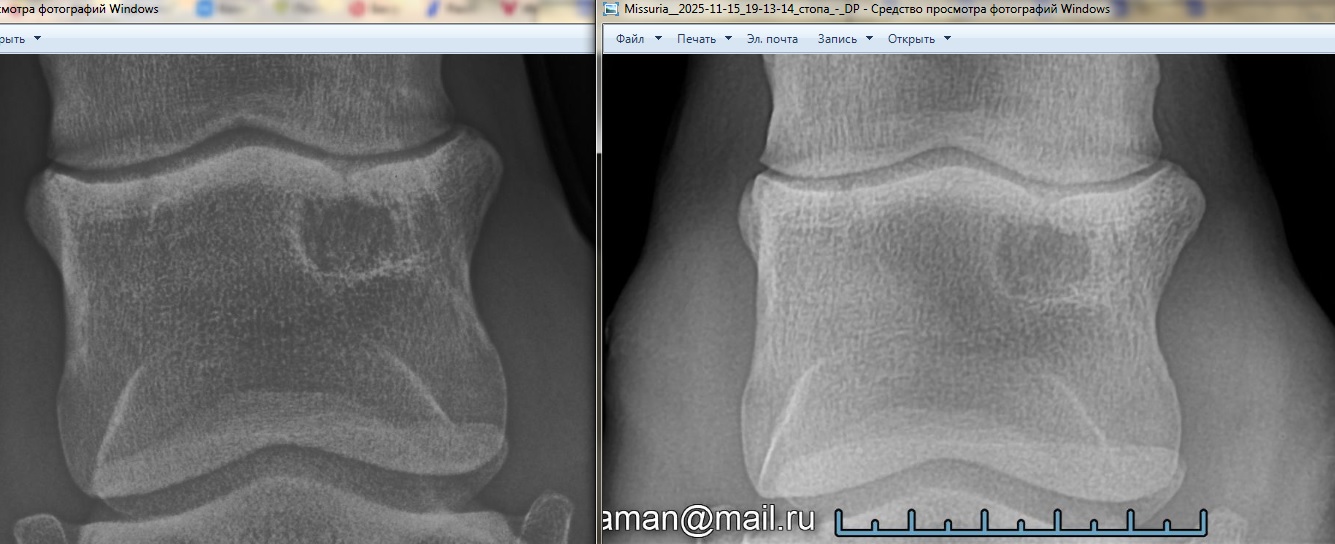 Рентген 19-25 ЛЗ 1.jpg