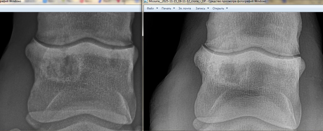 Рентген 19-25 ПЗ 1.jpg