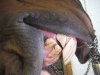 overbite.jpg