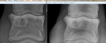 Рентген 19-25 ПЗ 1.jpg