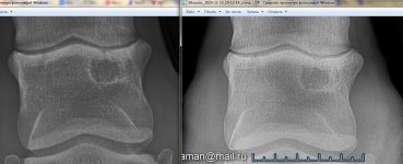 Рентген 19-25 ЛЗ 1.jpg