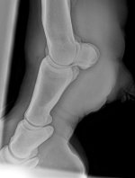 00009725_00015409_DICOM_DX_2026_07_22_0000035821(1).jpg