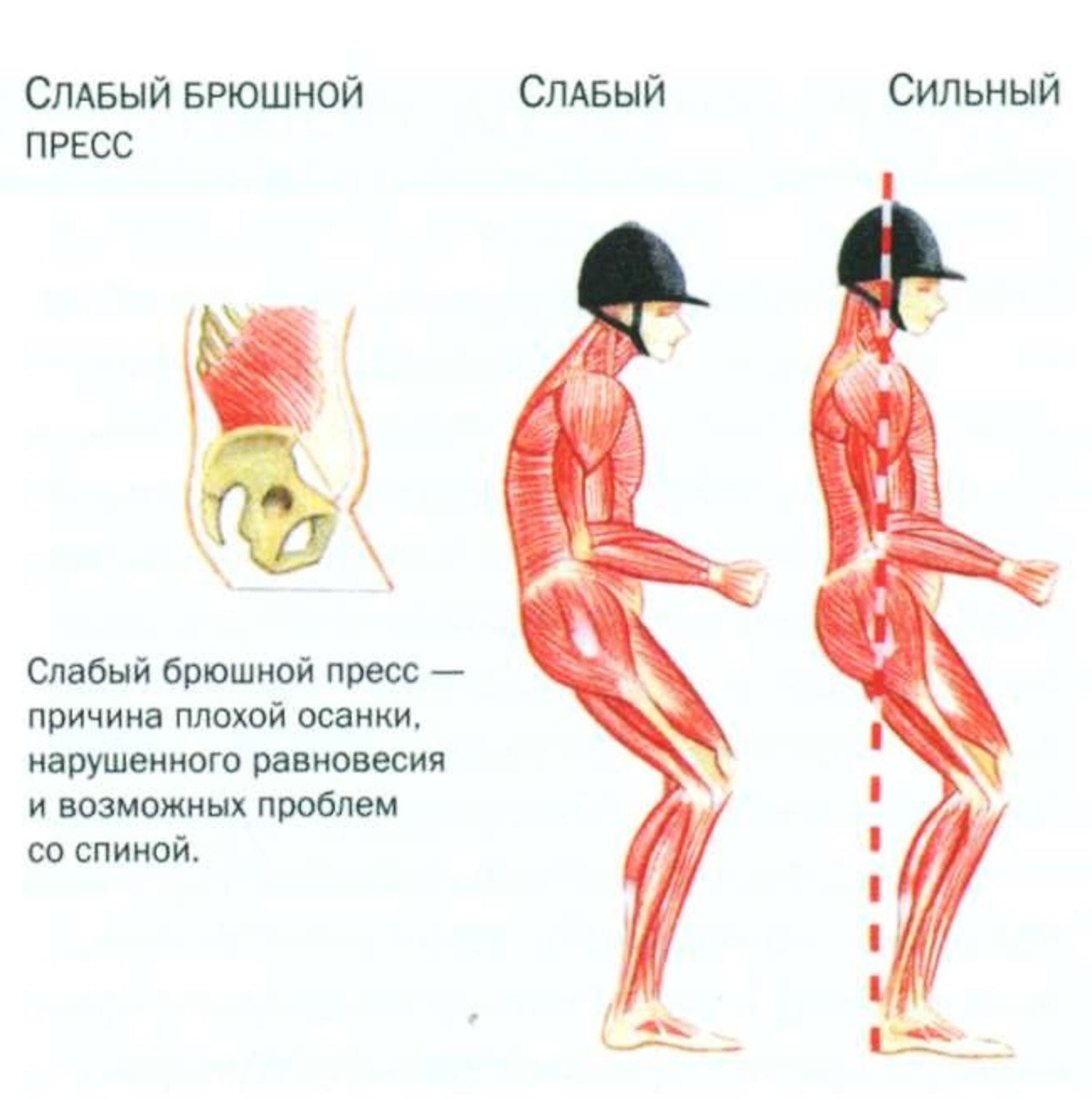 Слабая поясница. Слабые мышцы. Мышцы спины для осанки. Слабые мышцы спины. Мышцы поясницы.