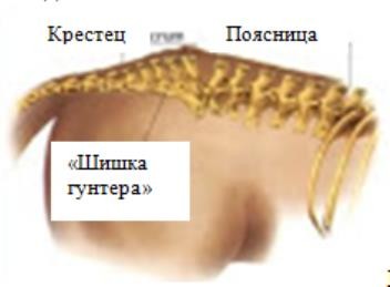 Крестцовый отдел позвоночника лошади